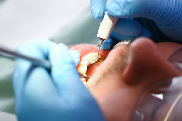 Best Pediatric Emergency Dentist in Lakeland Village, CA